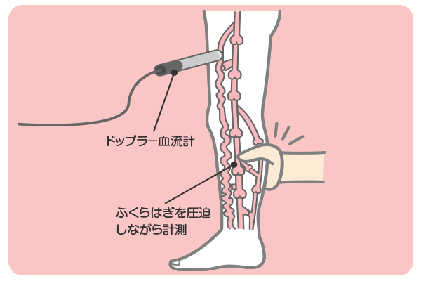ドップラー診察